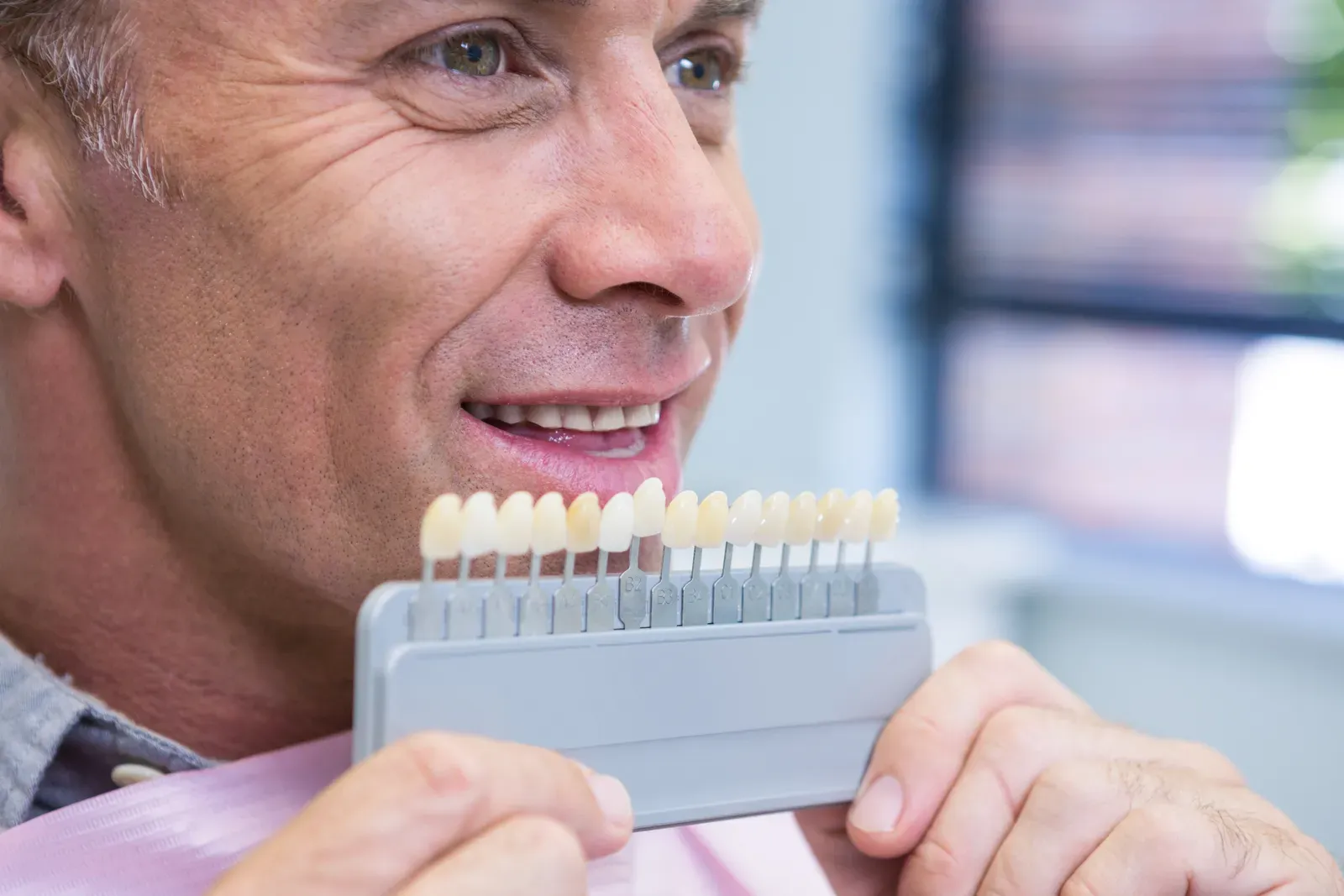 Porcelain Veneers: Cost, Process & What to Expect