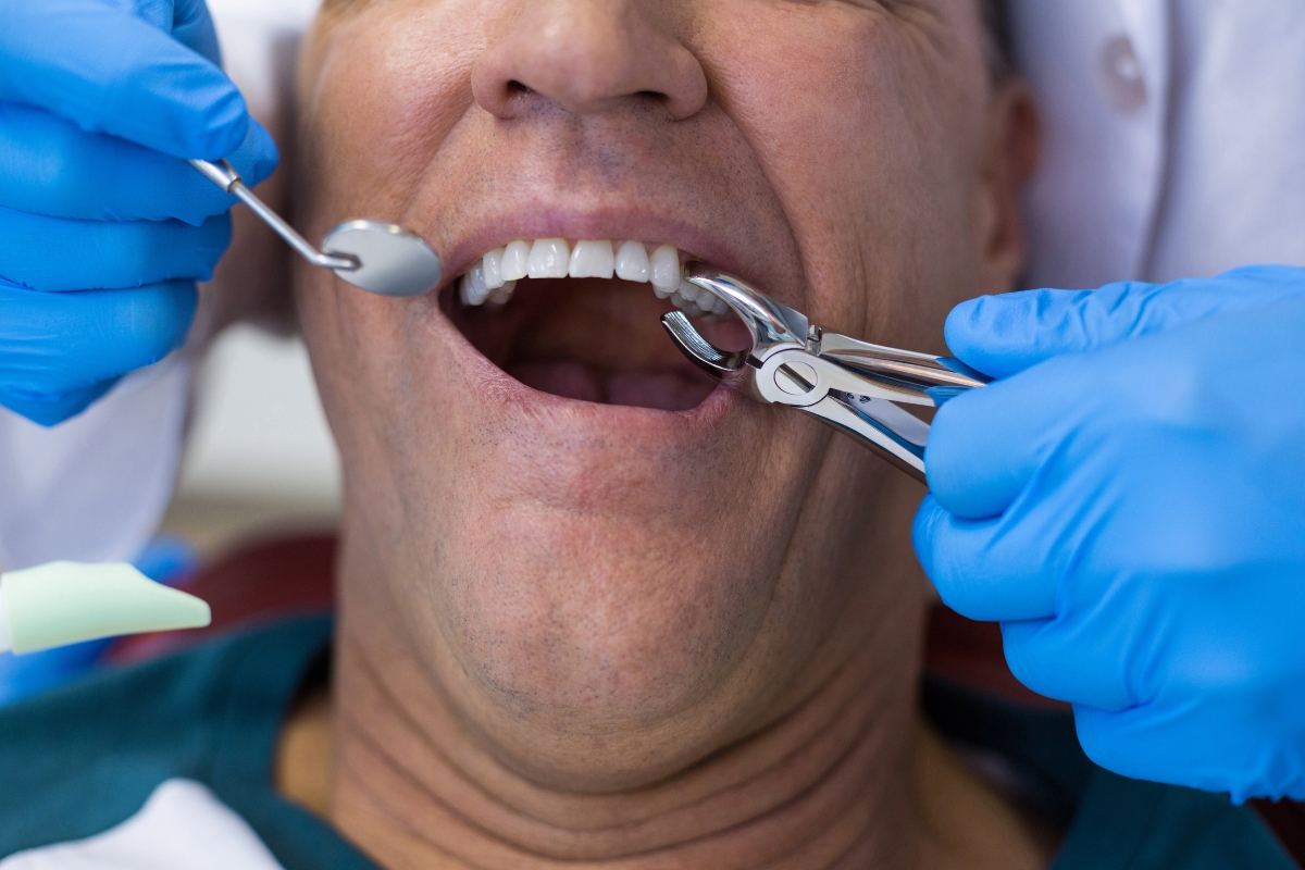 tooth-extractions-in-Phoenix